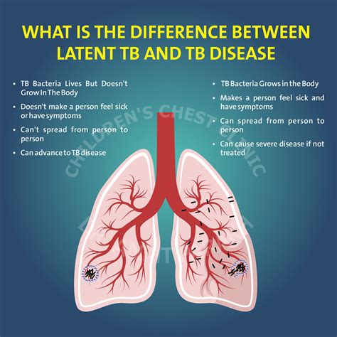 dating someone with latent tb